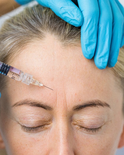 Woman receiving BOTOX for glabellar lines