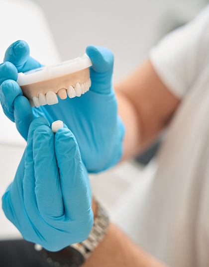 a dentist showing how a crown fits over a tooth using a model