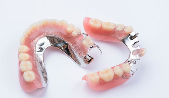 Two partial dentures pictured against neutral background