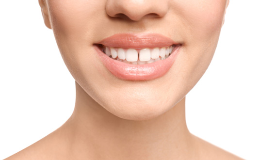 Woman’s smile with gap between front teeth